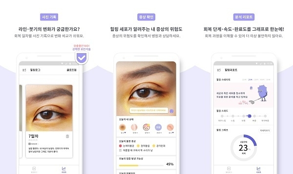 케어마인드가 신규 론칭한 성형 후 회복 분석 전문 모바일 어플리케이션 에포터